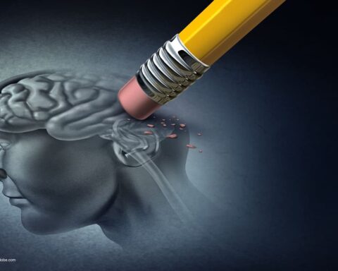 Omega 3 zapobiega chorobie Alzheimera