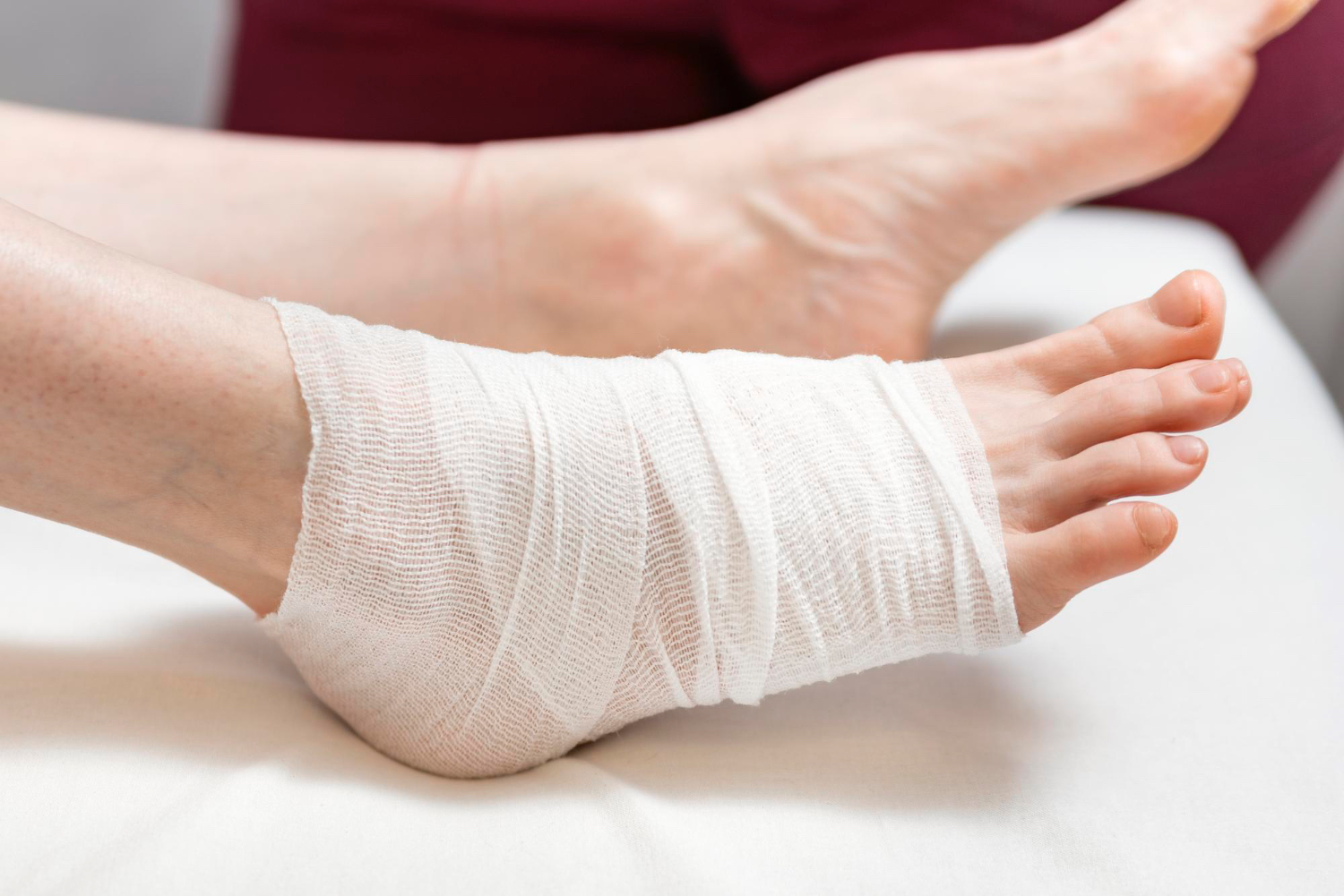 Ustąpienie owrzodzenia tętniczego za pomocą chelatacji z EDTA