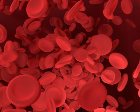 „Lekka” anemia?